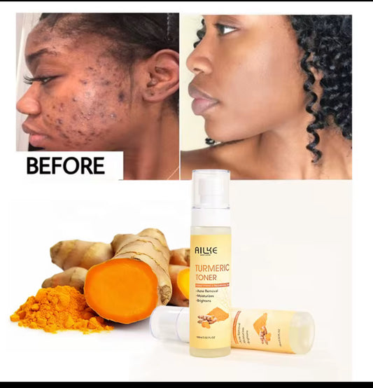 Anti acne Turmeric Toner